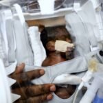 New device enables parents to hold premature infants, enhancing early skin-to-skin contact