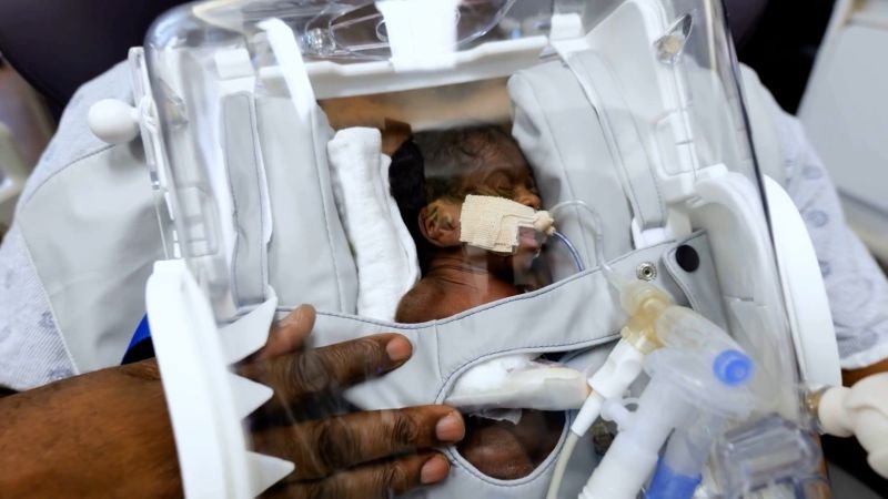 New device enables parents to hold premature infants, enhancing early skin-to-skin contact
